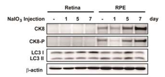 western blot analysis를 통해 황반변성 동물모 델 망막조직에서의 케라틴8의 발현 및 인산화 증가와 자 가포식작용 마커 관찰