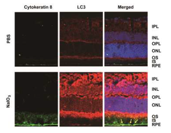 산화스트레스 유발 동물모델 망막조직에서 의 자가포식작용 마커 단백질과 케라틴8의 발현증가