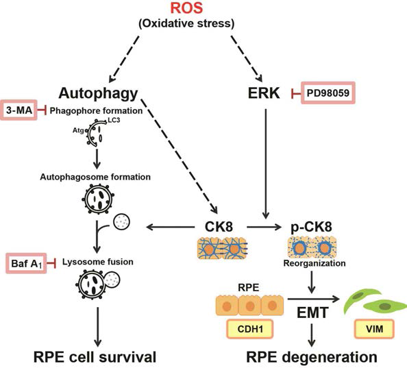 산화 스트레스에 의 한 황반변성 발병 기전 모식 도. 자가포식 작용(autophagy) 및 케라틴8에 의한 RPE 세포 생존과 ERK에 의한 케라틴8 인산화를 통한 망막상피세포의 변성 유도