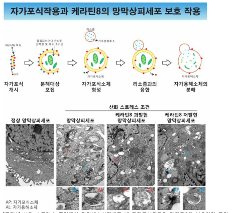 산화 스트레스 조건에서 망막색소상피세포 내 자가포식작용과 케라틴8의 보호역할 규명