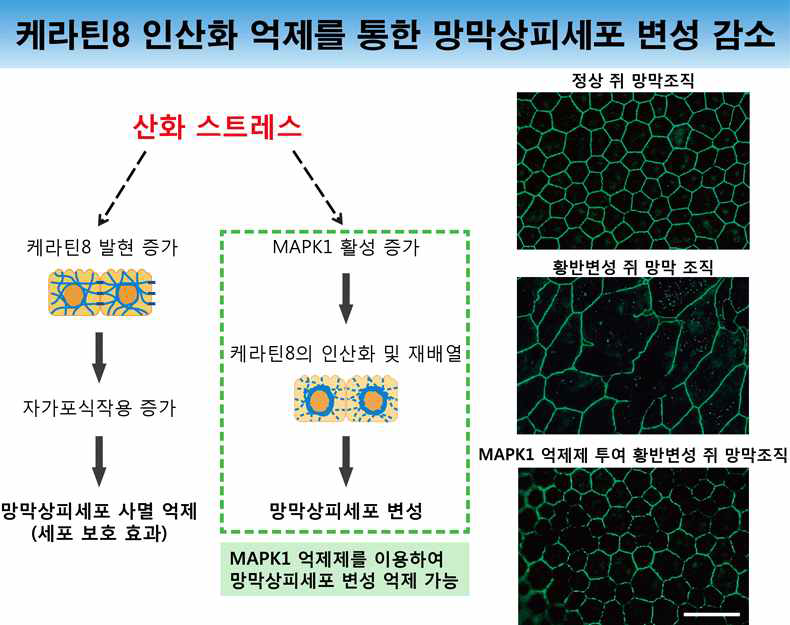  2] 케라틴8 인산화 및 재배열 억제로 망막색소상피세포의 변성 완화 확인