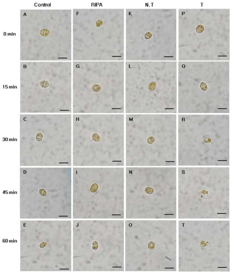 Micrographs of the algicidal process of H. circularisquama HA 92-1 treated total protein of transgenic tobacco (2.5 ㎍/㎖).