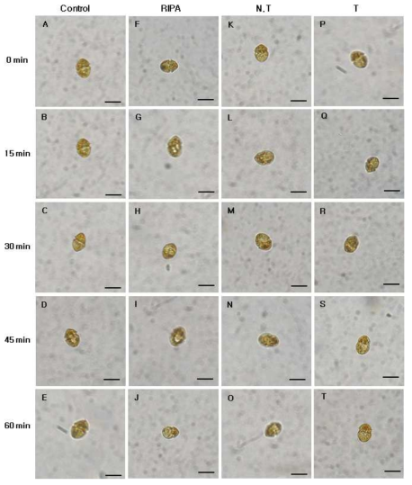 Micrographs of the algicidal process of H. circularisquama HU 9436 treated total protein of transgenic tobacco (2.5 ㎍/㎖).