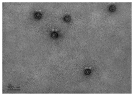 대장균 내에서 발현된 재조합 HcRNAV34의 TEM 촬영 사진