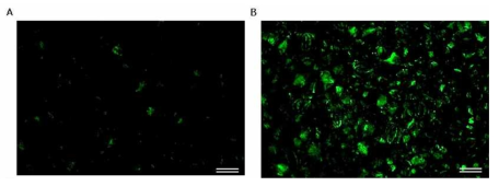 Localization of HcRNAV34 VLP::GFP in a transgenic tobacco leaf.