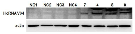 Western blot analysis of HcRNAV34 VLP protein expression in transgenic tobacco.