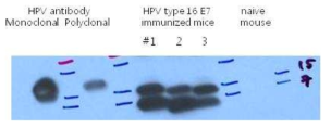 E7 발현 DNA plasmid 및 E7 재조합 단백질을 투여한 마우스에서 E7 항체 생성 확인