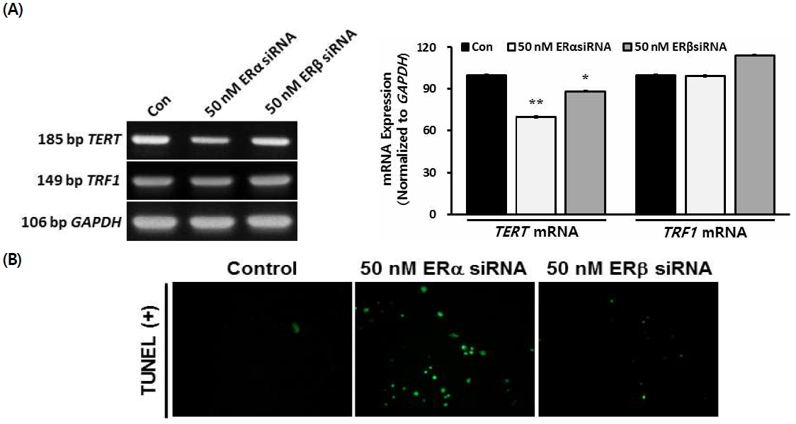 Effects of silencing of ERs via siRNA in motoneuron cells.