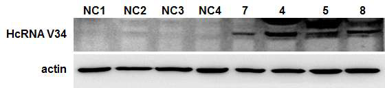 Western blot analysis of HcRNAV34 VLP protein expression in transgenic tobacco