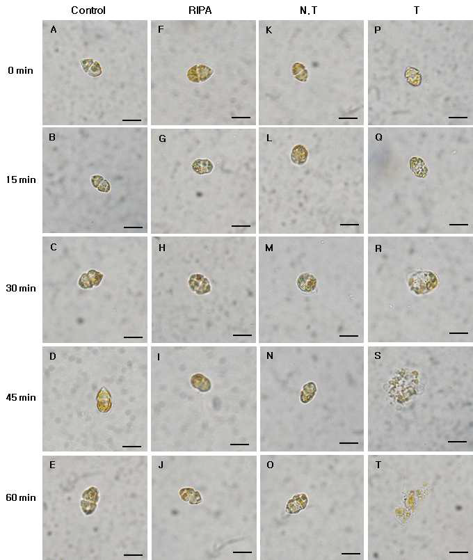 Micrographs of the algicidal process of H . circularisquama HU 9433-P treated total protein of transgenic tobacco (2.5 ㎍/㎖).