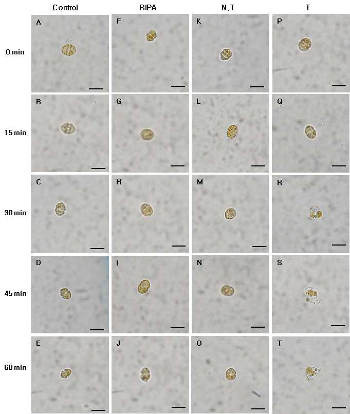Micrographs of the algicidal process of H . circularisquama HA 92-1 treated total protein of transgenic tobacco (2.5 ㎍/㎖).