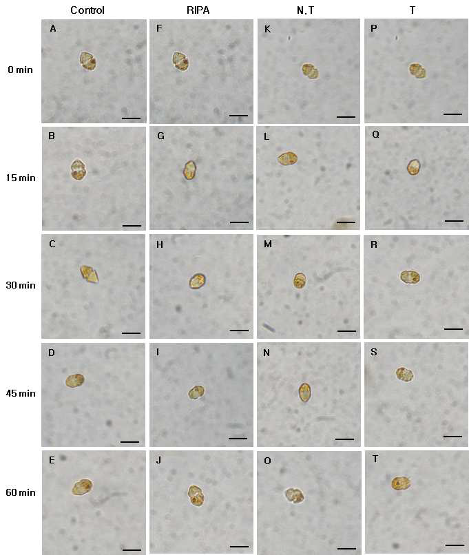 Micrographs of the algicidal process of H . circularisquama HU 9423 treated total protein of transgenic tobacco (2.5 ㎍/㎖).