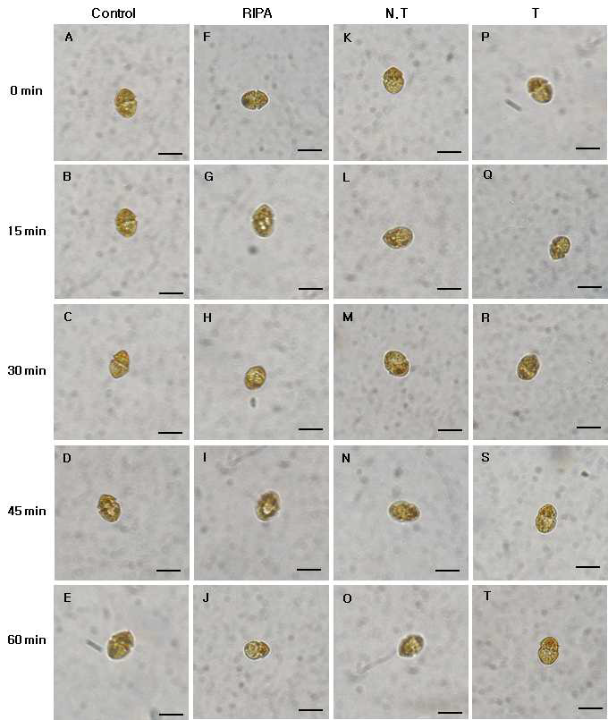 Micrographs of the algicidal process of H . circularisquama HU 9436 treated total protein of transgenic tobacco (2.5 ㎍/㎖).