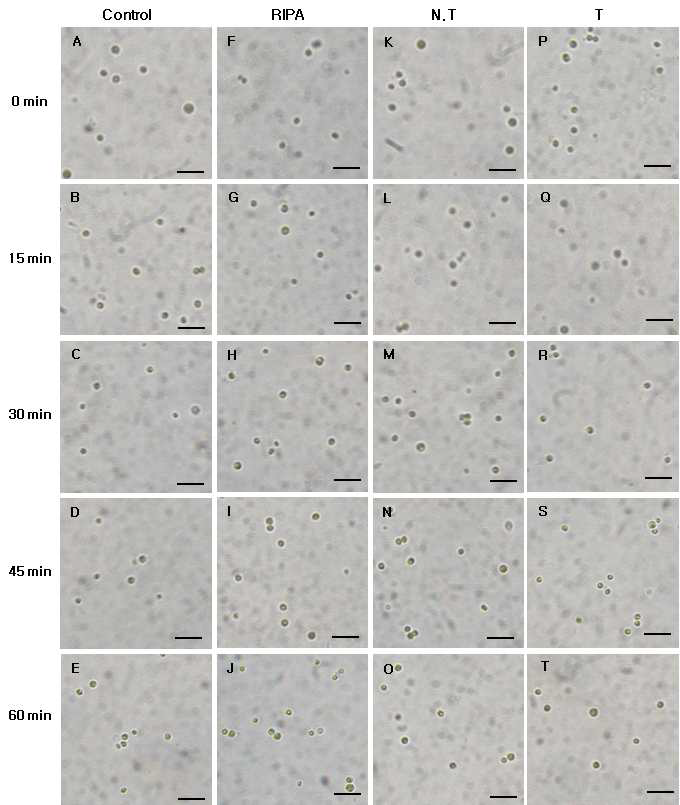 Micrographs of the algicidal process of C. vulgaris treated total protein of transgenic tobacco (2.5 ㎍/㎖).