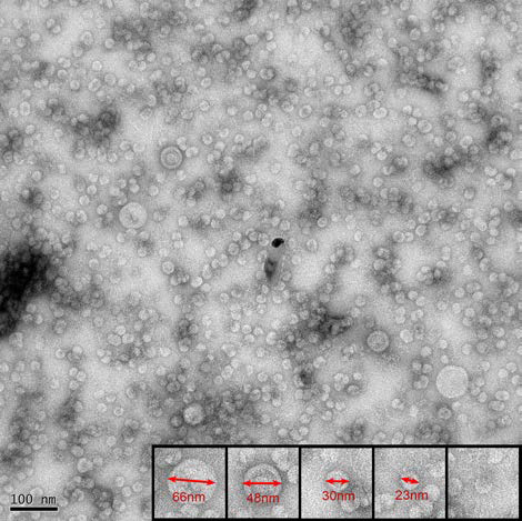 네거티브 염색된 HcRNAV34 VLP의 이미지