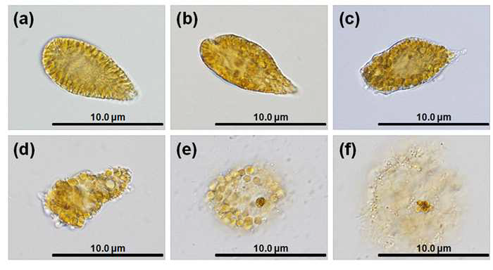 광학현미경을 이용한 TD 49 1μM 처리 후 Chattonella marina의 형태관찰