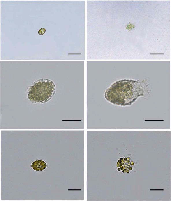 Light microscopic observation of Heterosigma akashiwo (above), Chattonella marina (middle) and Chattonella sp.