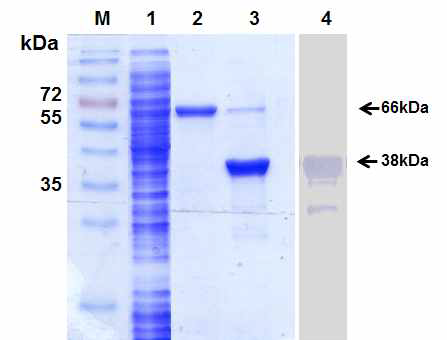 대장균 내에서 발현된 재조합 HcRNAV34 캡시드 단백질의 정제