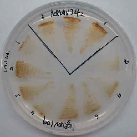 HcRNAV109와 HcRNAV34의 캡시드 단백질 발현을 위한 선발된 Phaeodactylum tricornutum 형질전환체