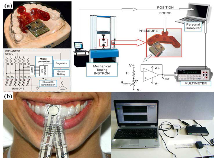 (a) 무선통신 기법을 활용한 구강 운동 분석, (b) FSR을 이용한 혀-치아-입술간의 접촉 인터페이스 분석