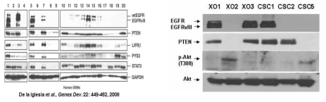 1차 배양 뇌암세포주들의 EGFR/EGFRvIII/PTEN 발현양상