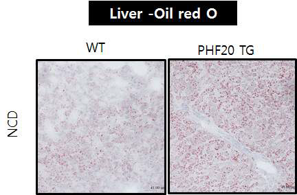 Wild Type과 PHF20 TG 마우스의 간에서 Oil red O 염색을 한 결과, TG마우스의 간에 지방축 척이 증가된 것을 확인하였다