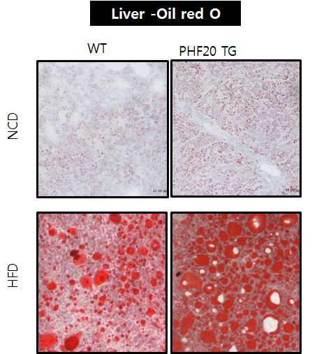 WT과 PHF20 TG 마우스를 60% high Fat diet 16주간 시행 후, 공복과 재 식이 후 간의 oil red O 염색