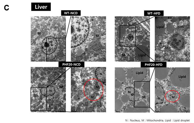 WT과 PHF20 TG 마우스를 60% high Fat diet 16주간 시행 후, 간의 TEM 사진