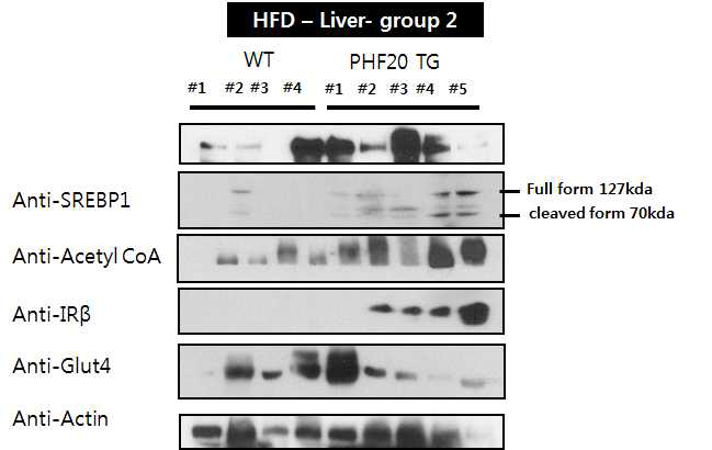 WT과 PHF20 TG 마우스를 60% high Fat diet 16주간 시행 후, 간에서의 지방합성 관련, Insulin receptor beta, glucose transpoter 4 단백질 량 확인