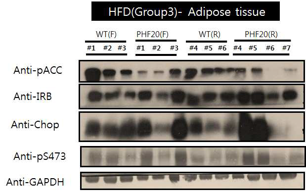 WT과 PHF20 TG 마우스를 60% high Fat diet 16주간 시행 후, 지방에서의 지방합성 관련 및 관련 단백질 량 확인