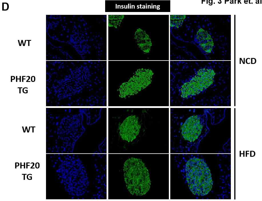 WT과 PHF20 TG 마우스를 NCD(첫째줄, 둘째줄 사진)와 60% high Fat diet (세째줄, 내째 줄 사진) 16주간 시행 후, 췌장의 islet 확인 (A)췌장 islet insulin 염색 췌장의 랑게르한스 섬을 인슐린을 IF(immunofluorescence)로 염색한 결과, NCD와 HFD 동일하게 PHF20 과발현 마우스에서 인슐린의 양이 증가 되어 있는 것을 확인하였다. 그림