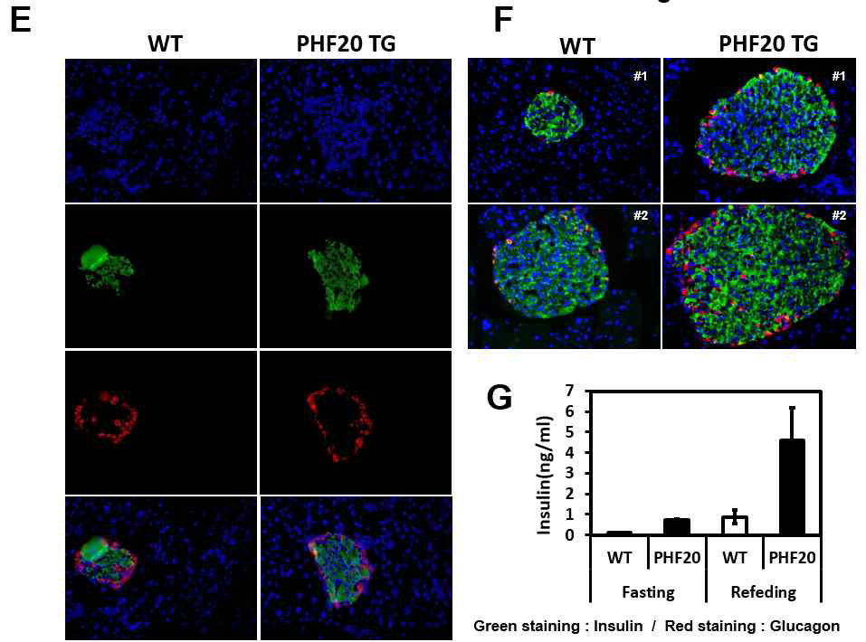 WT과 PHF20 TG 마우스를 12주 수컷 마우스 NCD(E)와 60% high Fat diet (F) 16주간 시 행 후, 췌장의 islet insulin과 glucagon 염색(E,F), 정상식이군에서 굶겼을 때와 굶겼다가 먹이를 먹이고 난 3시간 후 혈중 인슐린 양(G)