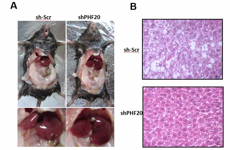 7주령 WT마우스에 sh-Lenti virus 와 sh-PHF20 Lenti virus (1X108 TU/ml)를 꼬리 정맥에 주사하고, 12주 동안60% 고지방식이 후 해부한 사진(A)과 hematoxylin staining(HE) 염색을 한 간 이미지(B)