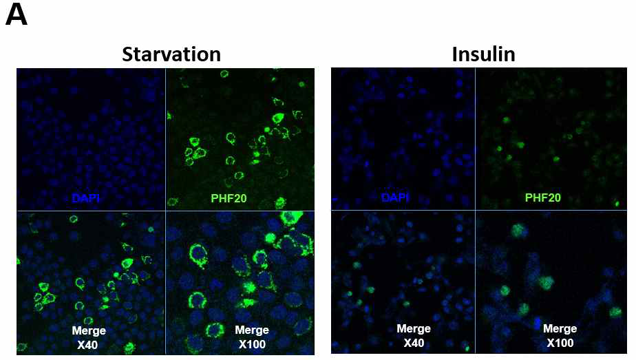 정상 인간 간 세포주인 Chang 세포주에 Doxycyclin 처리로 PHF20 inducible 한 상태에서 인슐 린 처리 유무에 따른 comforcal로 PHF20의 위치확인