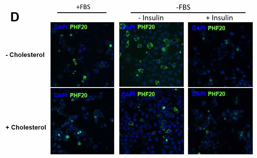 정상 인간 간 세포주인 Chang 세포주에서 Doxycyclin 처리로 PHF20 inducible 한 상태에서 인 슐린과 Cholesterol 처리 유무에 따른 comforcal로 PHF20 위치확인