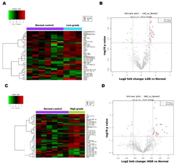 Heatmap showing differential miRNA expression in normal vs low-/high-grade dysplasia an d volcano plot graph of miRNA array results