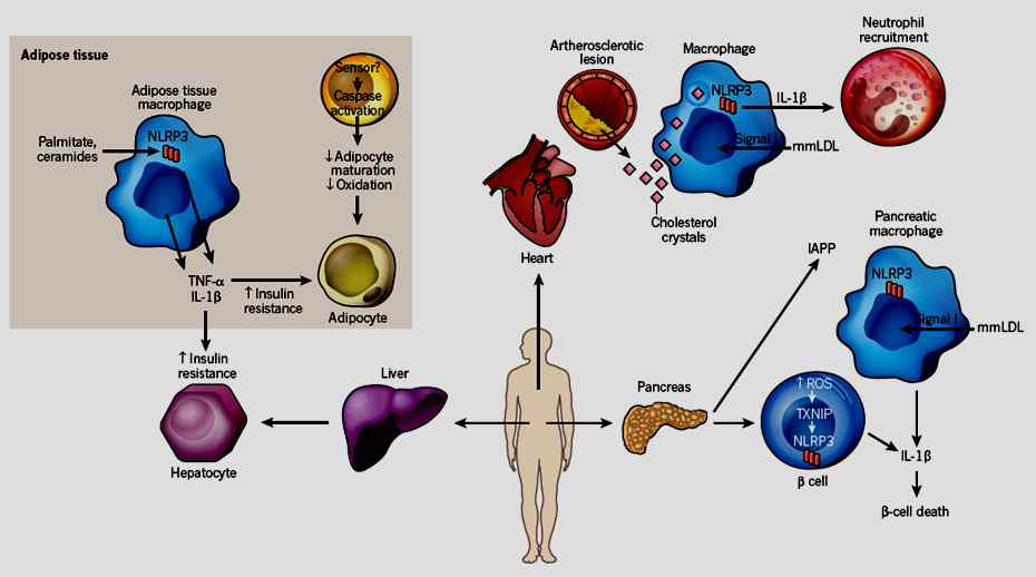 인슐린 표적 장기에서 인플라마솜 활성과 대사질환 발병과의 adipokine 및 염증 매개물질 연관성