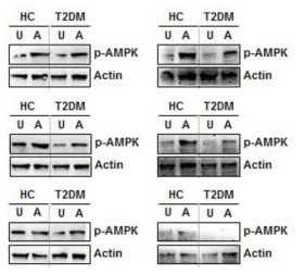 제2형 당뇨병 환자와 건강인 말초혈액 단핵세포에서 AMPK 활성도 측정