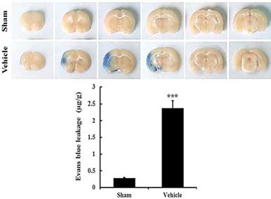 뇌허혈 유발 후 초기의 BBB 투과성 변화