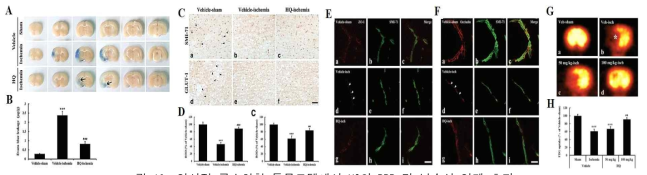 일시적 국소허혈 동물모델에서 HQ의 BBB 및 뇌손상 억제 효과