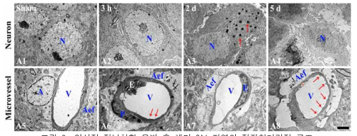 일시적 전뇌허혈 유발 후 해마 CA1 지역의 전자현미경적 구조