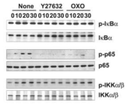 TAK1에 의한 NF-κB 활성 변화