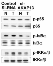 AKAP13과 NF-κB의 인산화
