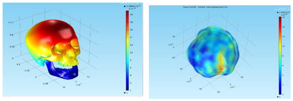 (좌) Time Transinet Result(1kHz) (우) Time Transinet Result(25kHz)