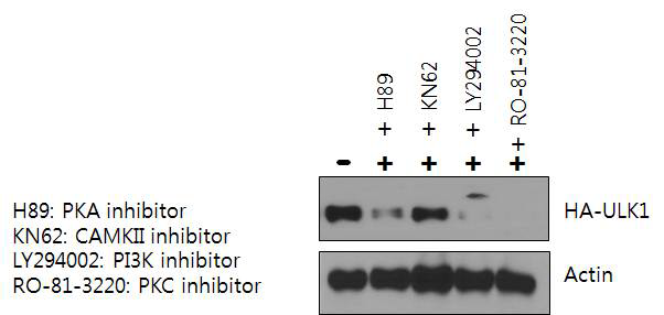 다양한 Serine/kinase 저해제가 ULK1의 분해에 미치는 영향 관찰