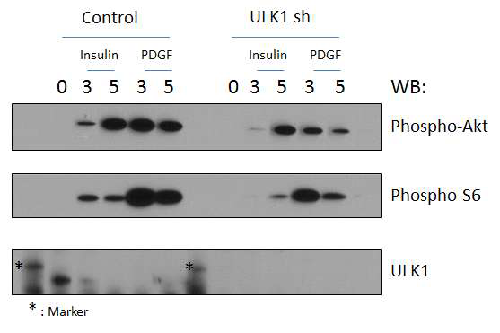 ULK1의 발현이 억제된 마우스 세포주에서 인슐린 또는 성장인자 자극을 준 후 신호전달 관찰