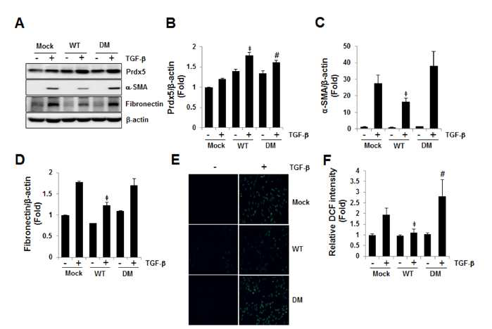 Anti-fibrotic effect of Prdx5 in TGF-β induced renal fibrosis and Prdx5 regulatory efficacy is peroxidase activity-dependent.