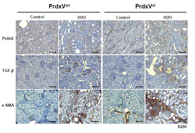 Immunohistochemistry (IHC) of fibrotic markers in UUO-induced PrdxVwt and PrdxVsi mouse kidney.