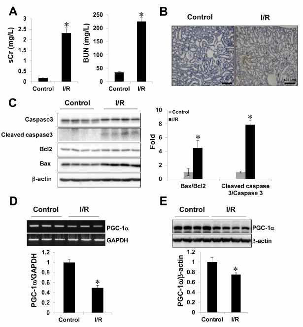 Activation of signal pathway in UUO-induced PrdxVwt and PrdxVsi mouse kidney