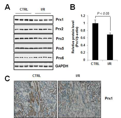 Expression level of Peroxiredoxins in I/R-induced kidney.